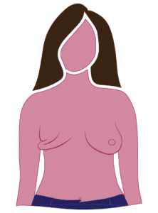 ABC 10268 Diamond RFS Breast Form